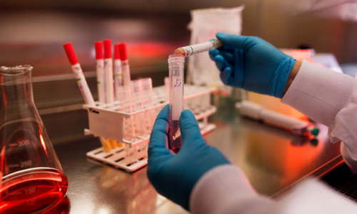 Laboratorio-alvo-de-operacao-policial-fraudava-exames-de-HIV-sifilis-e-hepatite-em-Mato-Grosso