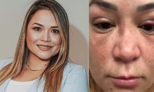 Sem-titulo-44-1024x579-1-615x410-1